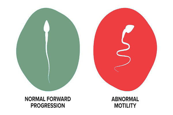 Low Sperm Motility (Asthenospermia)